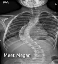 Megans-Xray200x219